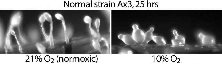 normal strain Ax3